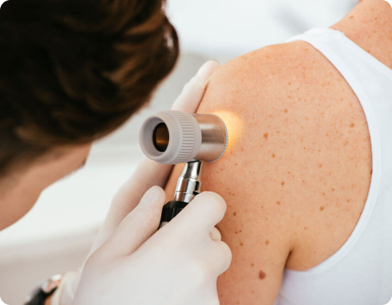 Dermatology